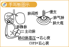 Rt(y)`ܿ}Էμ(COPD)\